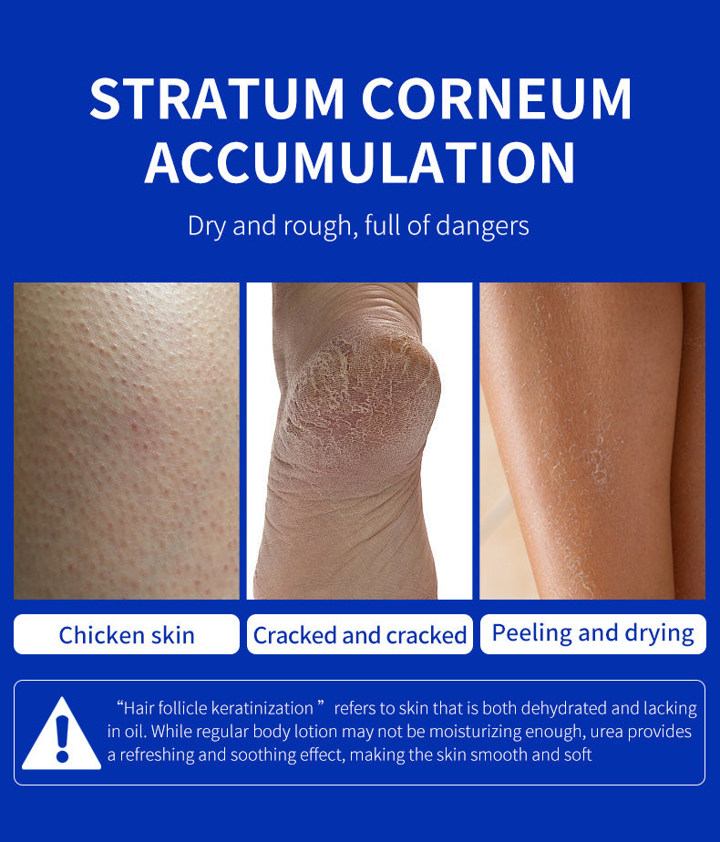 Blorfo 40% Urea Cream with 2% Salicylic Acid - Intensive Moisturizing & Exfoliating Formula for Calluses & Dry Skin - 3.52oz