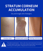 Blorfo 40% Urea Cream with 2% Salicylic Acid - Intensive Moisturizing & Exfoliating Formula for Calluses & Dry Skin - 3.52oz