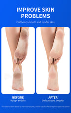 Blorfo 40% Urea Cream with 2% Salicylic Acid - Intensive Moisturizing & Exfoliating Formula for Calluses & Dry Skin - 3.52oz