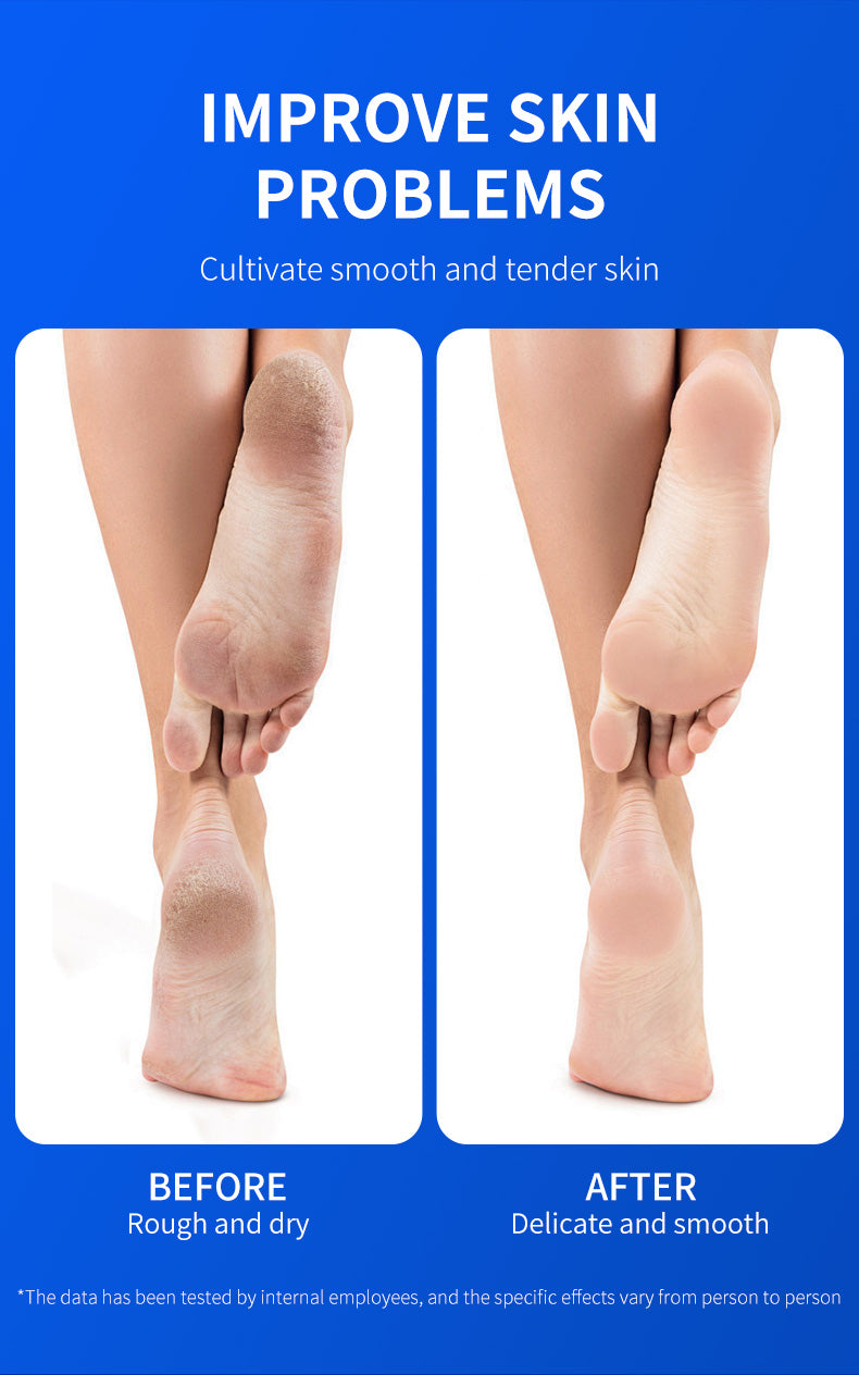 Blorfo 40% Urea Cream with 2% Salicylic Acid - Intensive Moisturizing & Exfoliating Formula for Calluses & Dry Skin - 3.52oz