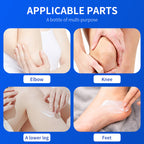 Blorfo 40% Urea Cream with 2% Salicylic Acid - Intensive Moisturizing & Exfoliating Formula for Calluses & Dry Skin - 3.52oz